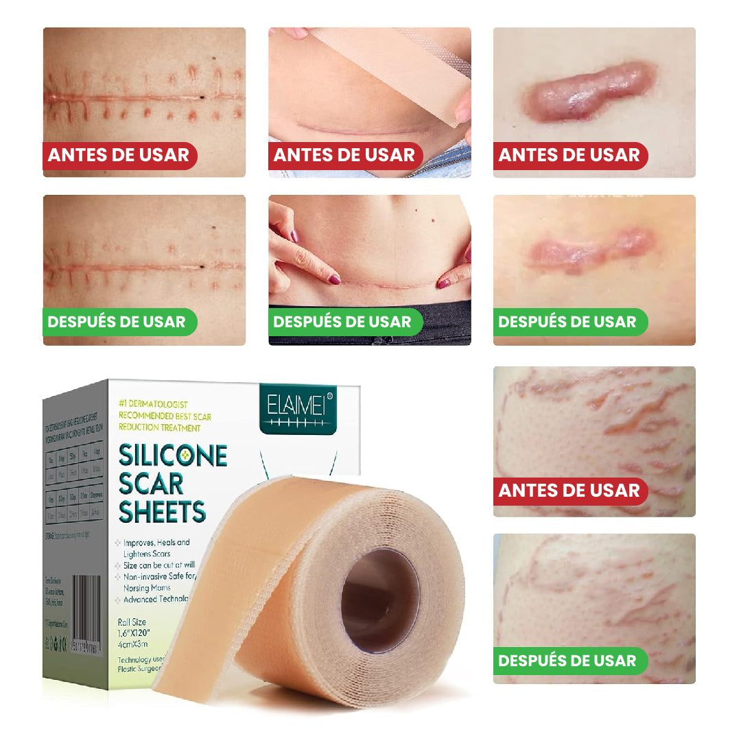🌿 ROLLO DE SILICONA PARA CICATRICES REPARACIÓN AVANZADA