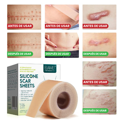 🌿 ROLLO DE SILICONA PARA CICATRICES REPARACIÓN AVANZADA