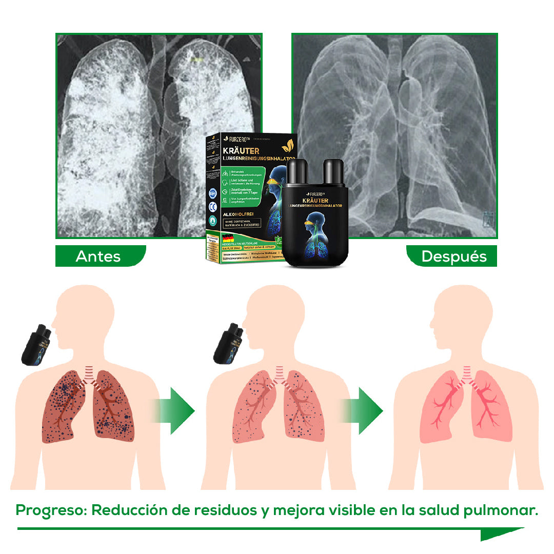 🌿 INHALADOR DE LIMPIEZA PULMONAR A BASE DE HIERBAS FURZERO™